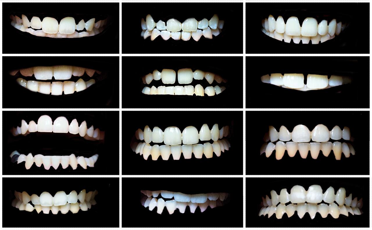 Collaged photograph of 12 unique sets of teeth.