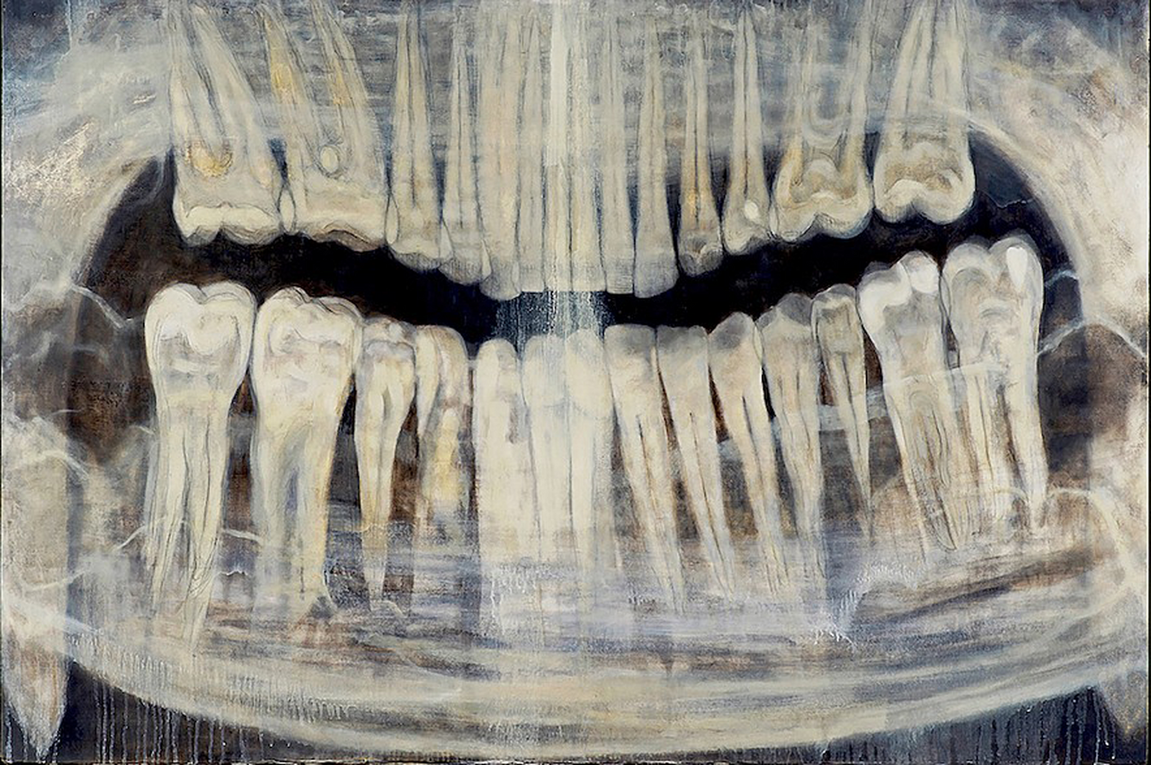A drawing of an X-ray image of the artist's teeth.